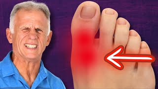 BIG Toe Pain!! RELIEF & Walk Normal Again (Hallux Rigidus)