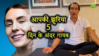 आपकी झुरिया 5  दिन के अंडर गायब | In 5 days बिना किसी दवा के |