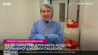 Bone regeneration technology: шанс уникнути ампутації та протезування. Вирощування кісток військовим