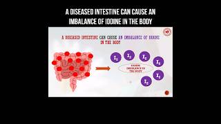 A diseased intestine can cause an imbalance of iodine in the body #intestine #iodine #disease