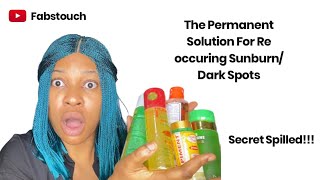 How to Clear Re-occuring Sunburn Permanently |  Clear  Sunburn, Dark spots, Malasma & Acne in 1 week