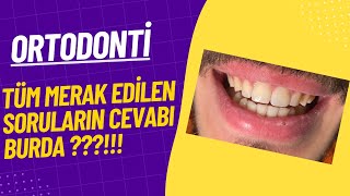 ORTODONTİ HAKKINDA MERAK EDİLEN HER ŞEY