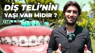 DİŞ TELİ TEDAVİSİ'NİN YAŞI VAR MIDIR ?