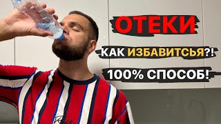 ОТЕКИ | Причины | Как избавиться?