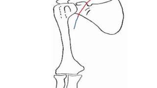 How to Biology & Anatomy: Arteries of the arm