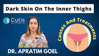 Dark Skin On The Inner Thighs | Pigmentation | Causes And Treatments | Cutis Skin Solution