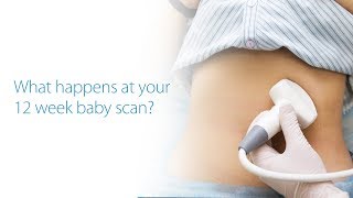 What to Expect At Your 12 Week Baby Scan? Dublin, Ireland.