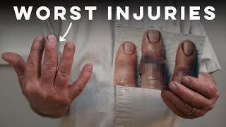 The Time I Almost Cut My Finger Off – Story Time