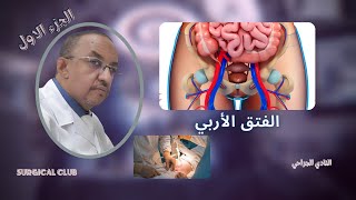 اسباب واعراض وعلاج الفتق اوالبعج inguinal herniaالجزء الاول