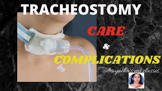 074.Tracheostomy: Postoperative care and complications. #postoprecovery #complication