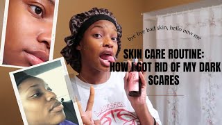 Vlogmas: Skin Care Routine // how I get rid of my dark marks