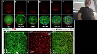 BCS.a_Sea Urchin Development_PMCs specification