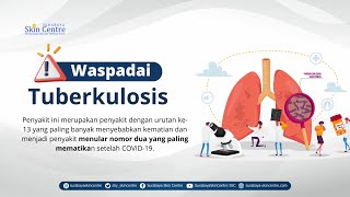 Waspadai Tuberkulosis Jika Anda Alami Gejala Ini!