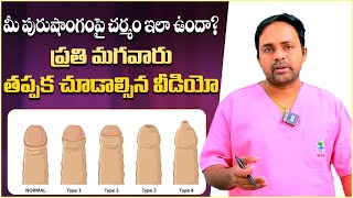 పురుషాంగం చర్మ సమస్యలు | Best Treatment for Foreskin Problems | KSR Stapler Circumcision | Vikram Tv