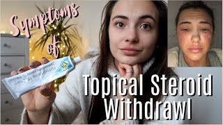 What are the symptoms of Topical Steroid Withdrawal?