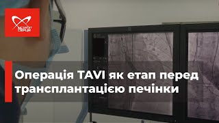 TAVI як етап перед трансплантацією печінки з приводу портальної гіпертензії 🔷 Інститут серця