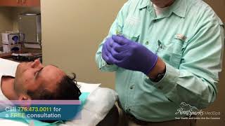 PRP (Platelet Rich Plasma) Scalp Injections for Hair Loss in Men  - Reno Sparks MedSpa