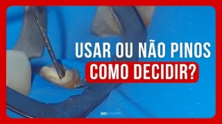 USAR OU NÃO PINOS COMO DECIDIR