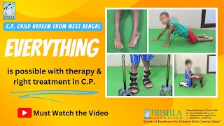 Cerebral Palsy Child Takes First Step! A Journey from Plaster to Progress | Trishla Foundation