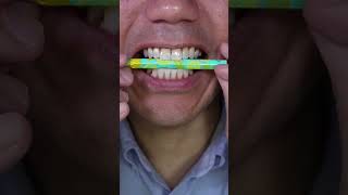 Nobel Super Soda Candy ASMR GOPAL ! #shorts##viral