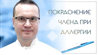 😕 Покраснение члена при аллергии. Клинический случай №97