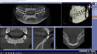 MANUAL DE INSTALACIÓN DEL PROGRAMA GALILEOS DEL TOMÓGRAFO DENTAL ORTHOPHOS SL 3D (SIRONA)