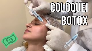 COLOQUEI BOTOX! 💉 Primeira vez! Doeu? Preços, resultados e mais!