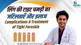 फिमोसिस के इलाज || Symptoms of Phimosis || Tight Foreskin Treatment in Hindi || Dr Abhilash Nali