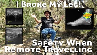 I broke my leg! Safety When Travelling in Remote Areas | @4xAdventures #4wd #touring