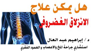 هل يمكن علاج الإنزلاق الغضروفى بدون جراحة مع الدكتور ابراهيم عبد العال