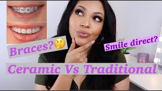 BRACES + TRADITIONAL VS CERAMIC + SMILE DIRECT JOURNEY+THINGS YOU SHOULD HAVE BEFORE BRACES