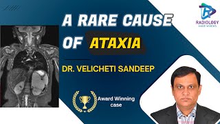 A Rare Cause of Ataxia#Dr.Velcheti Sandeep