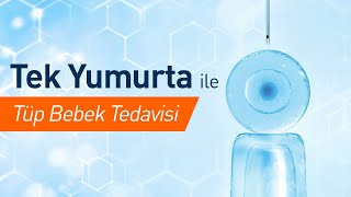 Tek Yumurta Kaçıncı Gün Transfer Edilir? Tüp Bebek Tedavisinde Tek Yumurta Başarı Şansı Nedir?