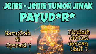 Jenis-Jenis Tumor Jinak Pada PAYUD*RA - Ternyata tdk semua harus di OPERASI