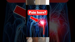 How To Relieve Sciatica Pain .. #shorts #sciatica #pain