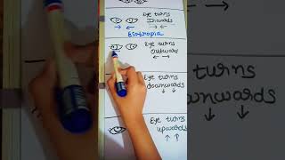 NORMAL EYE VS ABNORMAL EYES TERMS (opthal terms)