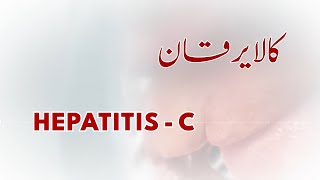 Be aware of Hepatitis-C - A life-threatening disease!