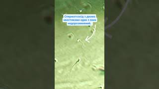 Abnormal human sperm. Аномальний сперматозоїд людини. #embrio #sperm #icsi #ivf #abnormal #human