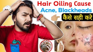 Hair Oiling Cause Acne, Blackheads | How to Clean Acne, Blackheads