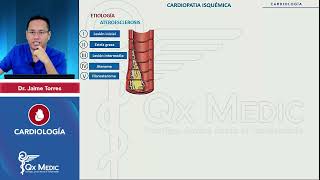 2024 CARDIOLOGÍA   Cardiopatía isquémica  Aspectos generales