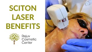 Sciton Laser Benefits- Rejuv Cosmetic Center NJ