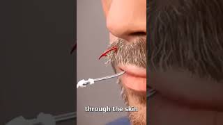 Removing A Fish Hook Your Lip🤯#shortvideo #shorts