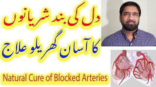 Blocked Arteries Treatment | Blocked Coronary Artery home remedy | Cure Blocked or Clogged arteries