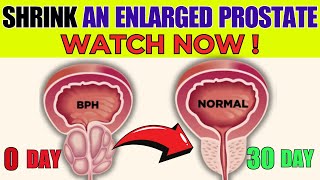 Shrink An Enlarged Prostate - Top 7 important vitamins you should know - Bestie Foods