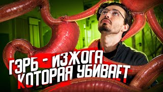 Что такое ГЭРБ или ИЗЖОГА, которая убивает - [История Медицины]