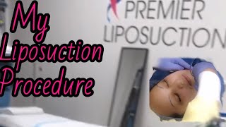 My CHIN LIPOSUCTION Procedure