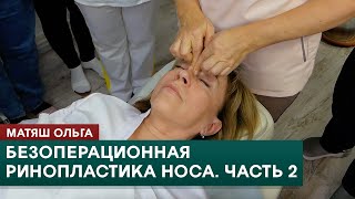 Безоперационная ринопластика носа. Часть 2. Скульптурный массаж лица. Ольга Матяш