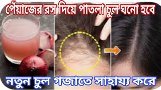 টাক মাথাতেও নতুন চুল গজাতে সাহায্য করে এই পেঁয়াজের রস এইভাবে ব্যবহার করে দেখো