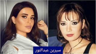 شاهد تحول8 فنانات عربيات قبل وبعد عمليات التجميل