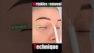 Wrinkles Removal Technique #shorts #short #nursing #wrinkles #viral